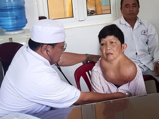 Phẫu thuật thành công cho người phụ nữ 30 năm mang  bướu giáp khổng lồ trên cổ