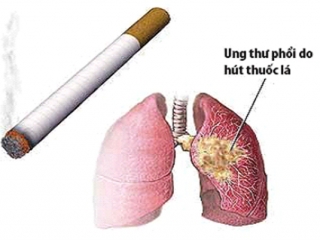 HÚT THUỐC LÁ CÓ HẠI NHƯ THẾ NÀO?