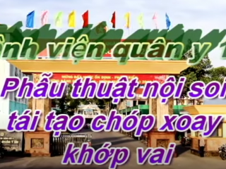 VIDEO “PHẪU THUẬT NỘI SOI TÁI TẠO CHÓP XOAY KHỚP VAI” TẠI BỆNH VIỆN QUÂN Y 120